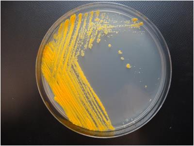 Characterization of Mycobacterium salfingeri sp. nov.: A novel nontuberculous mycobacteria isolated from a human wound infection